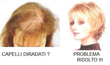 parrucche 100% human hair, infoltitori,toupets,